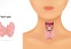 Báo động tình trạng gia tăng người mắc bệnh nhân giáp