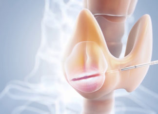 Chế độ ăn uống hợp lý cho người mắc bệnh nhân giáp