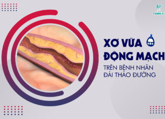 Xơ vữa động mạch trên bệnh nhân đái tháo đường có nguy hiểm hay không?