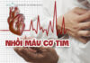 Nhồi máu cơ tim