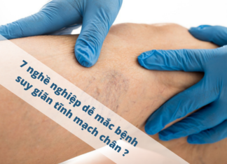 7 nghề nghiệp dễ bị mắc bệnh suy giãn tĩnh mạch chân