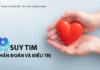 Suy tim – chẩn đoán và điều trị