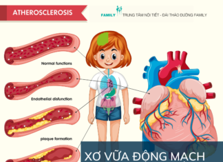 Xơ vữa động mạch nguy hiểm không?