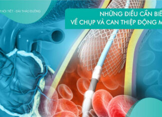 Những điều cần biết về chụp và can thiệp động mạch vành