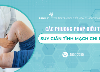 Các phương pháp điều trị suy giãn tĩnh mạch chi dưới