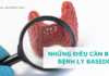 Những điều cần biết về bệnh lý Basedow