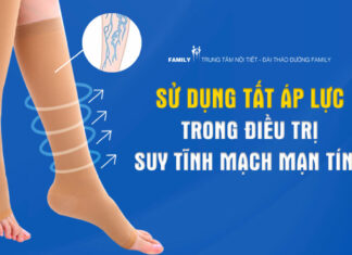 Sử dụng tất áp lực trong điều trị suy tĩnh mạch mạn tính